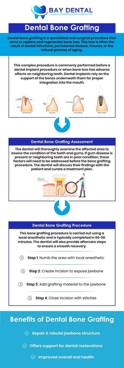 Common questions asked by patients: What is bone grafting and why is it needed for dental implants? How does bone grafting help improve dental implant stability? Who may need a bone graft before getting dental implants? What can you expect during a bone grafting procedure for dental implants? For more information, contact us today or book an appointment online. We are conveniently located at 3620 S. Bristol St, #307, Santa Ana, CA. We serve patients from Santa Ana CA, Tustin CA, Irvine CA, Garden Grove CA, Fountain Valley CA, Costa Mesa CA, and surrounding areas. Common questions asked by patients: What is bone grafting and why is it needed for dental implants? How does bone grafting help improve dental implant stability? Who may need a bone graft before getting dental implants? What can you expect during a bone grafting procedure for dental implants? For more information, contact us today or book an appointment online. We are conveniently located at 3620 S. Bristol St, #307, Santa Ana, CA. We serve patients from Santa Ana CA, Tustin CA, Irvine CA, Garden Grove CA, Fountain Valley CA, Costa Mesa CA, and surrounding areas.
