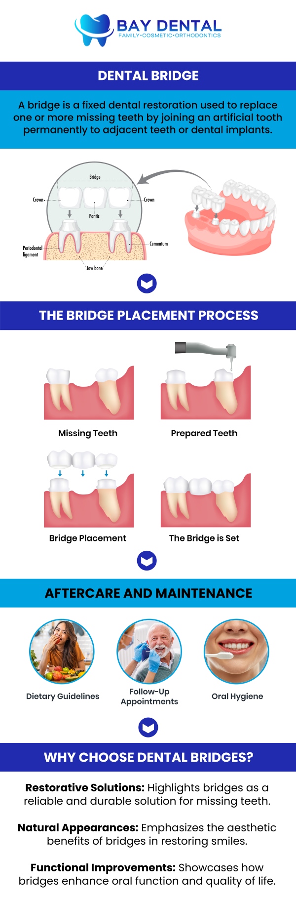 Dr. Linda Pearce, DDS at Bay Dental helps patients address missing teeth with personalized dental bridge solutions. Treatment plans are designed to restore smile balance, improve dental function, and support overall oral wellness. For more information, contact us or request an appointment online. We are conveniently located at 3620 S. Bristol St, #307, Santa Ana, CA.
