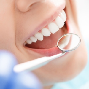 Dental Checkups in Santa Ana, CA