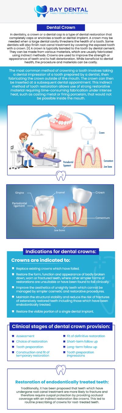 At Bay Dental, Dr. Linda Pearce, DDS provides customized dental crown treatments to help protect and restore damaged teeth. Our approach focuses on creating solutions that support tooth function, appearance, and lasting oral health. For more information, contact us or request an appointment online. We are conveniently located at 3620 S. Bristol St, #307, Santa Ana, CA.