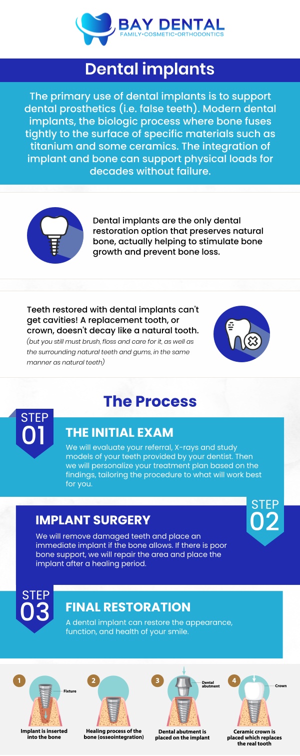 Bay Dental offers personalized dental implant consultations with Dr. Linda Pearce, DDS, to help patients explore solutions for missing teeth. Each treatment plan is designed around individual oral health needs, smile goals, and long-term dental function. For more information, contact us or request an appointment online. We are conveniently located at 3620 S. Bristol St, #307, Santa Ana, CA. Bay Dental offers personalized dental implant consultations with Dr. Linda Pearce, DDS, to help patients explore solutions for missing teeth. Each treatment plan is designed around individual oral health needs, smile goals, and long-term dental function. For more information, contact us or request an appointment online. We are conveniently located at 3620 S. Bristol St, #307, Santa Ana, CA.