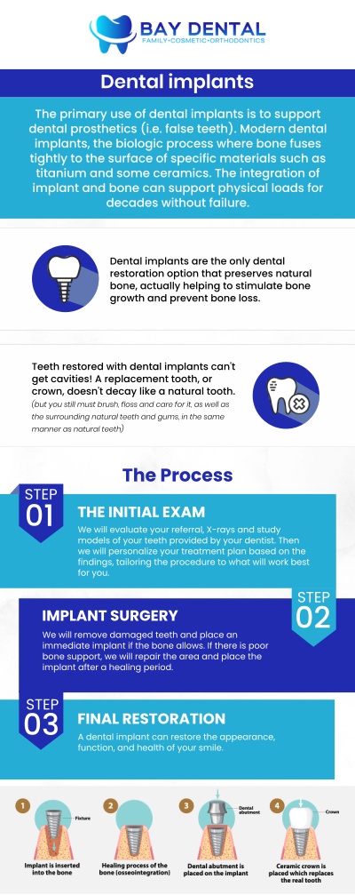 Bay Dental offers personalized dental implant consultations with Dr. Linda Pearce, DDS, to help patients explore solutions for missing teeth. Each treatment plan is designed around individual oral health needs, smile goals, and long-term dental function. For more information, contact us or request an appointment online. We are conveniently located at 3620 S. Bristol St, #307, Santa Ana, CA. Bay Dental offers personalized dental implant consultations with Dr. Linda Pearce, DDS, to help patients explore solutions for missing teeth. Each treatment plan is designed around individual oral health needs, smile goals, and long-term dental function. For more information, contact us or request an appointment online. We are conveniently located at 3620 S. Bristol St, #307, Santa Ana, CA.