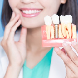 Dental Implants in Santa Ana, CA