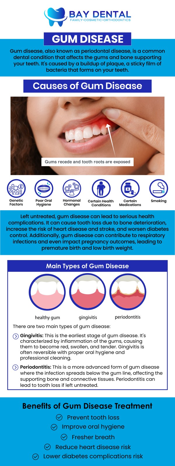 Effective gum disease treatment focuses on improving gum health and preventing further complications. Dr. Linda Pearce, DDS, provides personalized periodontal care to help patients maintain healthier gums and stronger smiles. For more information, contact us or request an appointment online. We are conveniently located at 3620 S. Bristol St, #307, Santa Ana, CA.