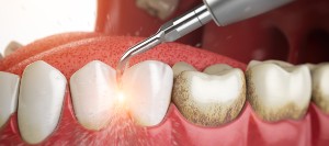 What Is a Periodontist? | Bay Dental What Is a Periodontist? | Bay Dental