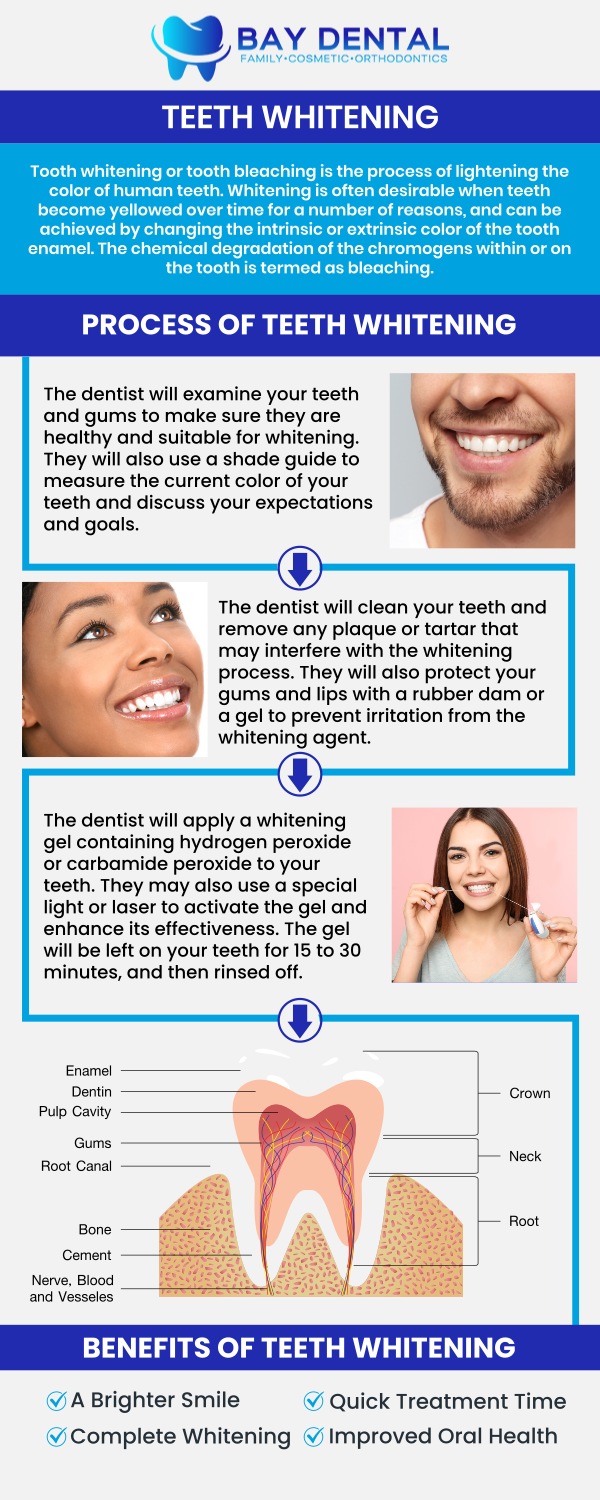 Explore personalized teeth whitening treatments designed to brighten your smile and improve confidence. Dr. Linda Pearce, DDS, provides customized cosmetic dental care focused on safe, effective, and natural-looking whitening results. For more information, contact us or request an appointment online. We are conveniently located at 3620 S. Bristol St, #307, Santa Ana, CA. Explore personalized teeth whitening treatments designed to brighten your smile and improve confidence. Dr. Linda Pearce, DDS, provides customized cosmetic dental care focused on safe, effective, and natural-looking whitening results. For more information, contact us or request an appointment online. We are conveniently located at 3620 S. Bristol St, #307, Santa Ana, CA.