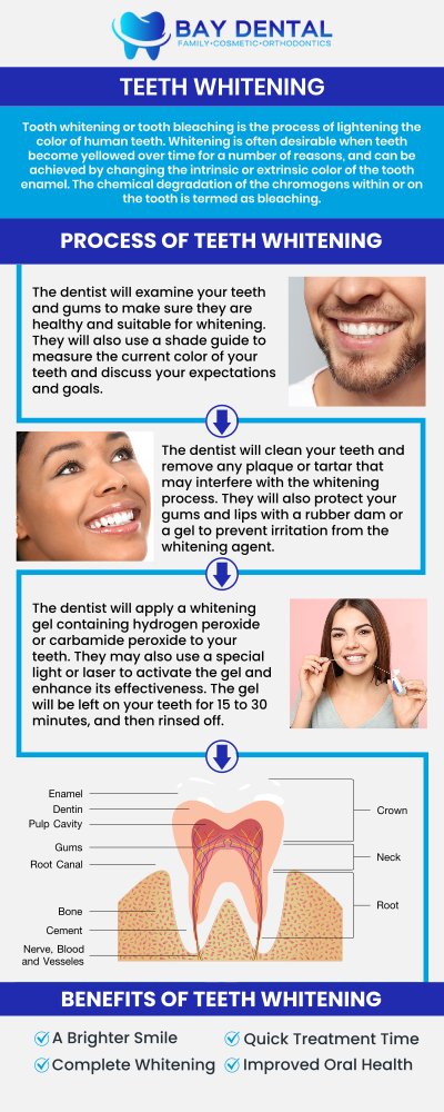 Explore personalized teeth whitening treatments designed to brighten your smile and improve confidence. Dr. Linda Pearce, DDS, provides customized cosmetic dental care focused on safe, effective, and natural-looking whitening results. For more information, contact us or request an appointment online. We are conveniently located at 3620 S. Bristol St, #307, Santa Ana, CA. Explore personalized teeth whitening treatments designed to brighten your smile and improve confidence. Dr. Linda Pearce, DDS, provides customized cosmetic dental care focused on safe, effective, and natural-looking whitening results. For more information, contact us or request an appointment online. We are conveniently located at 3620 S. Bristol St, #307, Santa Ana, CA.