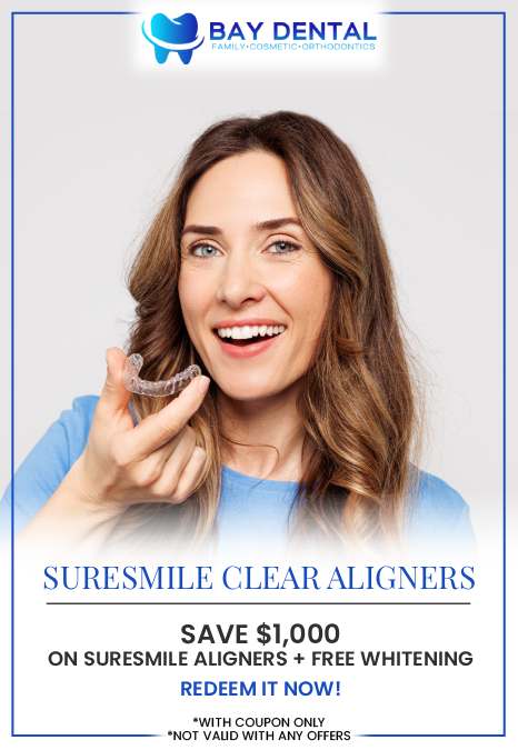 Common questions asked by patients: What are clear aligners and how do they work to straighten teeth? What are the benefits of choosing clear aligners over traditional braces? How long does clear aligner treatment usually take? How should you care for your teeth while wearing clear aligners? For more information, contact us today or book an appointment online. We are conveniently located at 3620 S. Bristol St, #307, Santa Ana, CA. We serve patients from Santa Ana CA, Tustin CA, Irvine CA, Garden Grove CA, Fountain Valley CA, Costa Mesa CA, and surrounding areas.