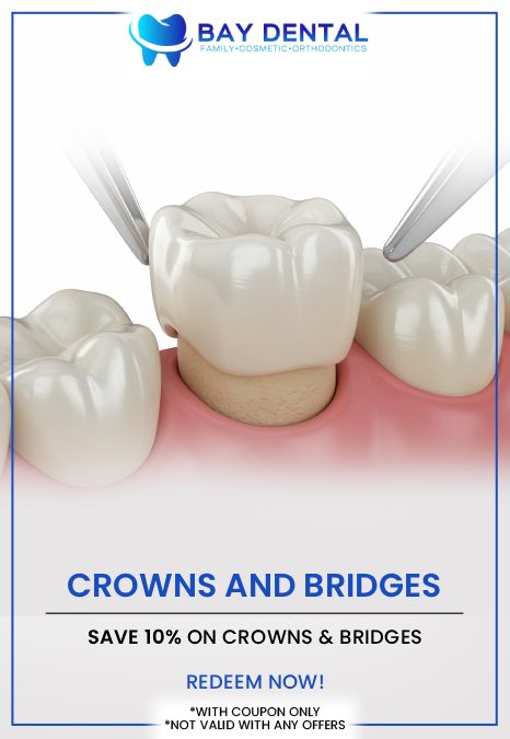 At Bay Dental, Dr. Linda Pearce, DDS provides customized dental crown treatments to help protect and restore damaged teeth. Our approach focuses on creating solutions that support tooth function, appearance, and lasting oral health. For more information, contact us or request an appointment online. We are conveniently located at 3620 S. Bristol St, #307, Santa Ana, CA.