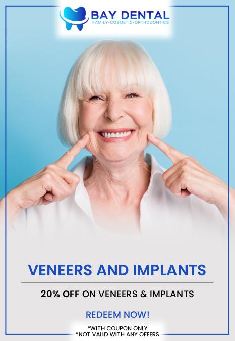 Bay Dental offers personalized dental implant consultations with Dr. Linda Pearce, DDS, to help patients explore solutions for missing teeth. Each treatment plan is designed around individual oral health needs, smile goals, and long-term dental function. For more information, contact us or request an appointment online. We are conveniently located at 3620 S. Bristol St, #307, Santa Ana, CA. Bay Dental offers personalized dental implant consultations with Dr. Linda Pearce, DDS, to help patients explore solutions for missing teeth. Each treatment plan is designed around individual oral health needs, smile goals, and long-term dental function. For more information, contact us or request an appointment online. We are conveniently located at 3620 S. Bristol St, #307, Santa Ana, CA.