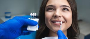 Porcelain Veneers Specialist in Santa Ana CA